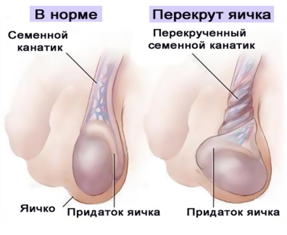 форма яичка члена фото 69